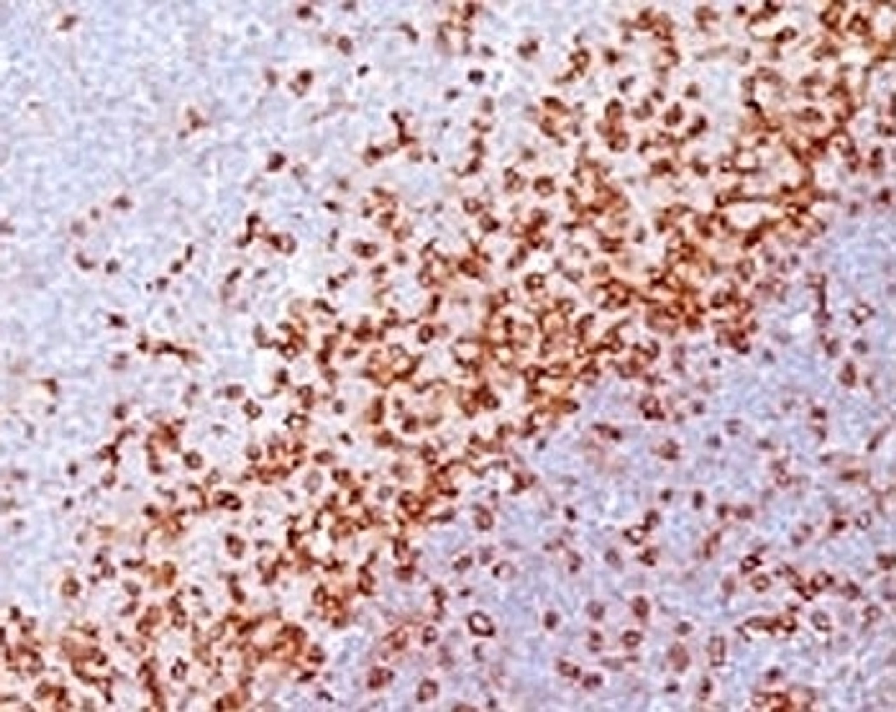 Formalin-fixed, paraffin-embedded human spleen stained with CD43 antibody (SPM503) .