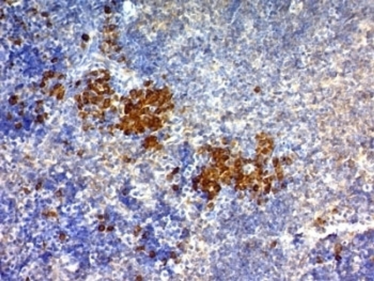 Formalin-fixed, paraffin-embedded mouse spleen stained with anti-CD63 antibody (SPM524) and DAB chromogen