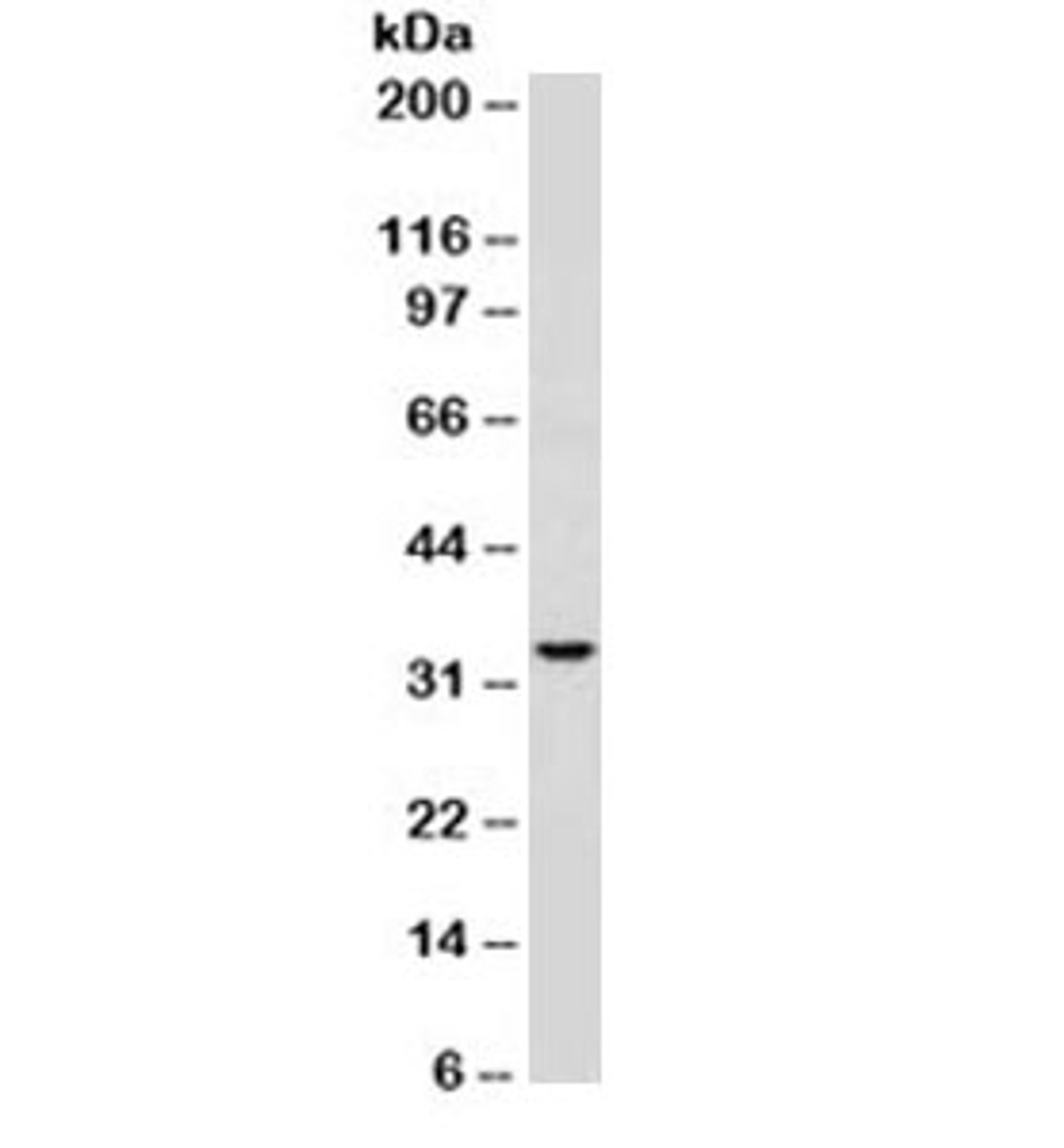 Western blot testing of Ramos cell lysate with anti-CD74 antibody (clone SPM523) . Predicted molecular weight ~33kDa.