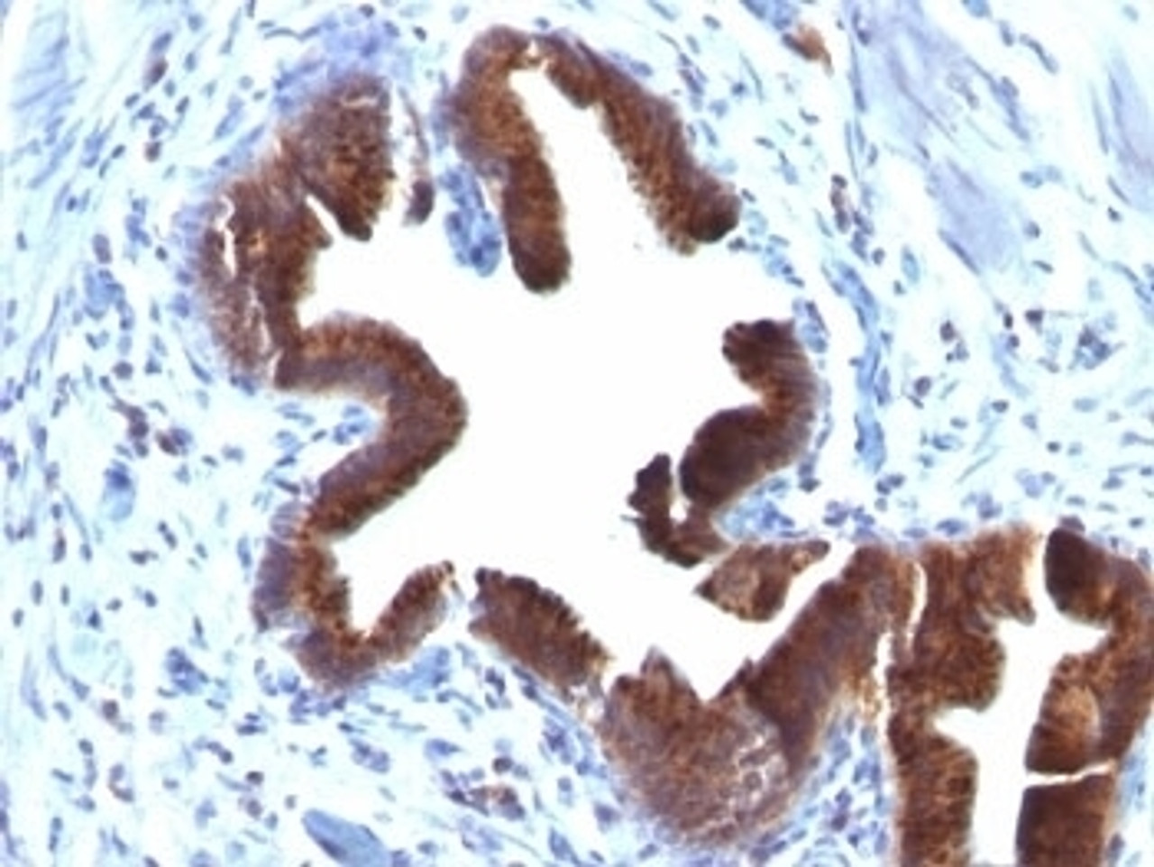 Formalin-fixed, paraffin-embedded human gallbladder stained with anti-Golgi antibody (SPM581) .