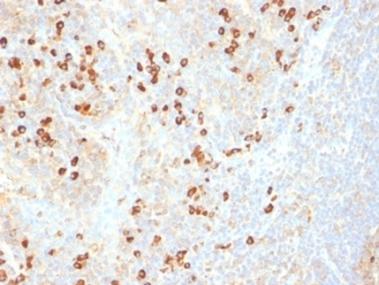 Formalin-fixed, paraffin-embedded human tonsil stained with Plasma cell Marker antibody (SPM310) .