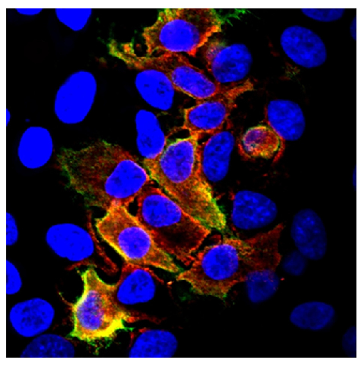 HeLa cells transfected with FLAG tagged porcine CD4.A vector were stained with Mouse Anti-Porcine CD4-PE (Cat. No. 99-145) and anti-FLAG followed by a secondary antibody and Hoechst 33342.

Image from Matsubara T, Nishii N, Takashima S, Takasu M, Imaeda N, Aiki-Oshimo K, et al. Identification and characterization of two CD4 alleles in Microminipigs. BMC Vet Res. 2016;12:222. Figure 6 (c)