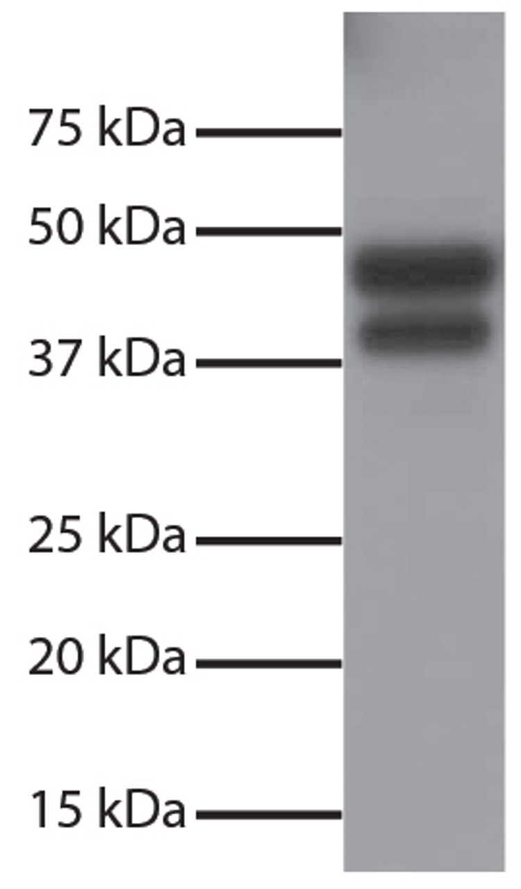 Total cell lysates from Jurkat cells were resolved by electrophoresis, transferred to PVDF membrane, and probed with Rabbit Anti-Human DR5-UNLB (Cat. No. 99-188) . Proteins were visualized using Goat Anti-Rabbit IgG (H+L) , Mouse/Human ads-HRP secondary antibody and chemiluminescent detection.