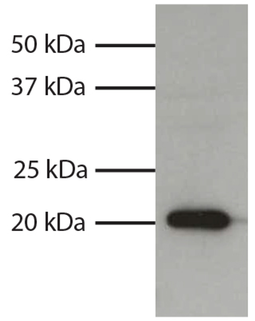 Total cell lysates from HL60 cells were resolved by electrophoresis, transferred to PVDF membrane, and probed with Mouse Anti-Human Bax-UNLB (Cat. No. 99-622) . Proteins were visualized using Goat Anti-Mouse IgG1, Human ads-HRP secondary antibody and chemiluminescent detection.