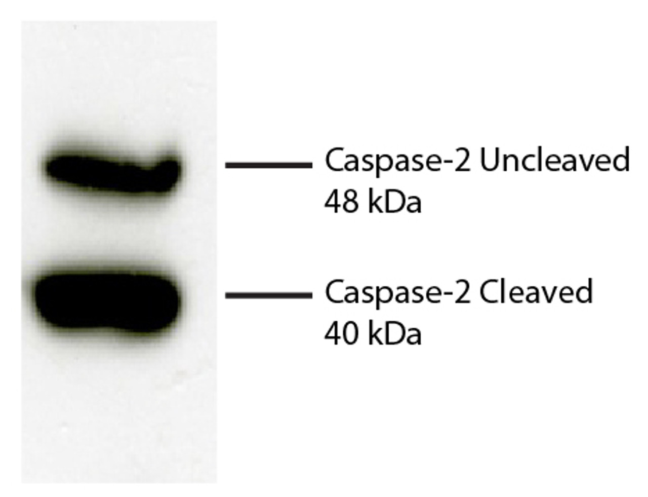 Total cell lysates from Jurkat cells were incubated with Rabbit Anti-Human DR5-UNLB, resolved by electrophoresis, transferred to PVDF membrane, and probed with Rat Anti-Human Caspase-2-UNLB (Cat. No. 99-808) . Proteins were visualized using Goat Anti-Rat IgM-HRP secondary antibody and chemiluminescent detection.