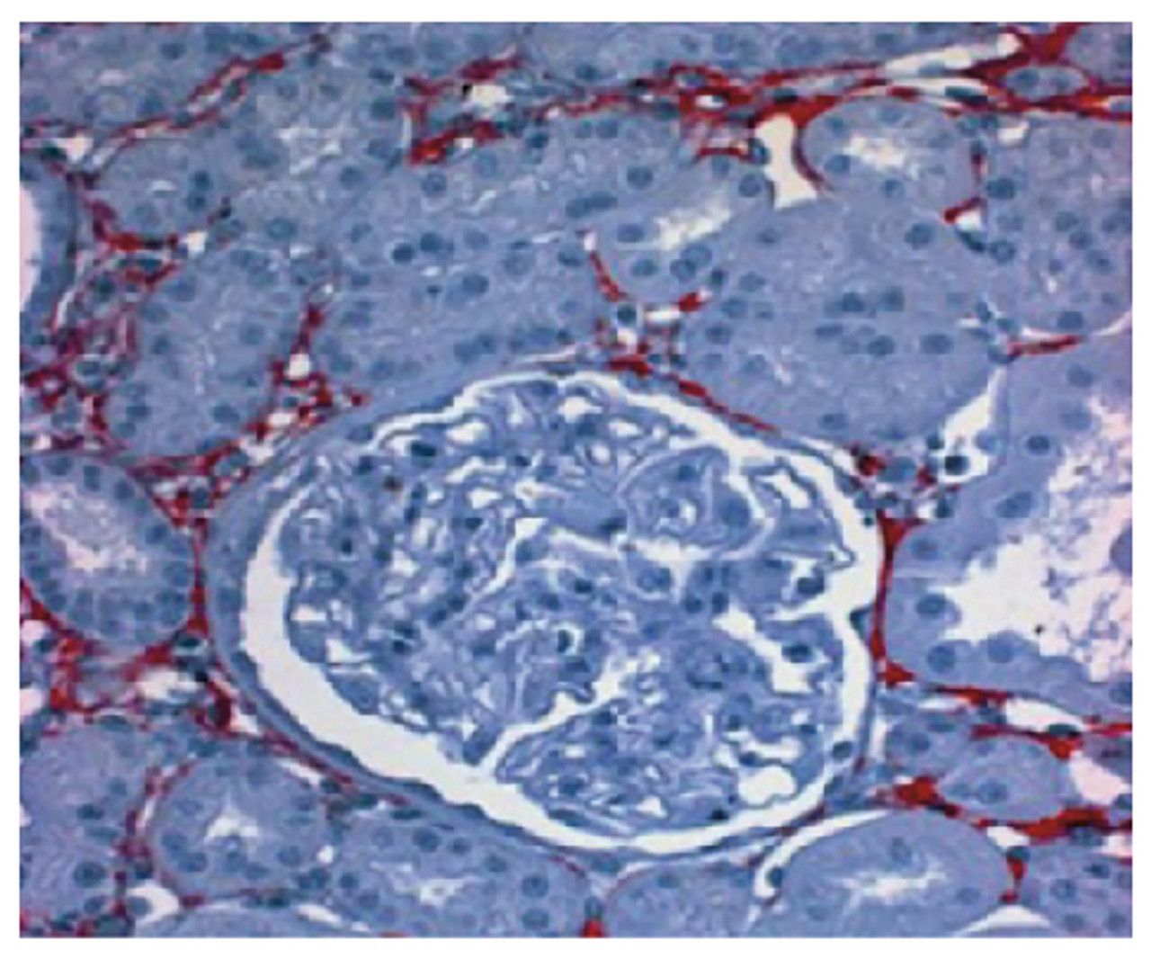 Paraffin embedded rat kidney section post uninephrectomy was stained with Goat Anti-Type I Collagen-UNLB (Cat. No. 98-500) followed by a secondary antibody and AEC.

Image from Wang-Rosenke Y, Khadzhynov D, Loof T, Mika A, Kawachi H, Neumayer H, et al. Tyrosine kinases inhibition by Imatinib slows progression in chronic anti-thy1 glomerulosclerosis of the rat. BMC Nephrol. 2013;14:223. Figure 3 (b)