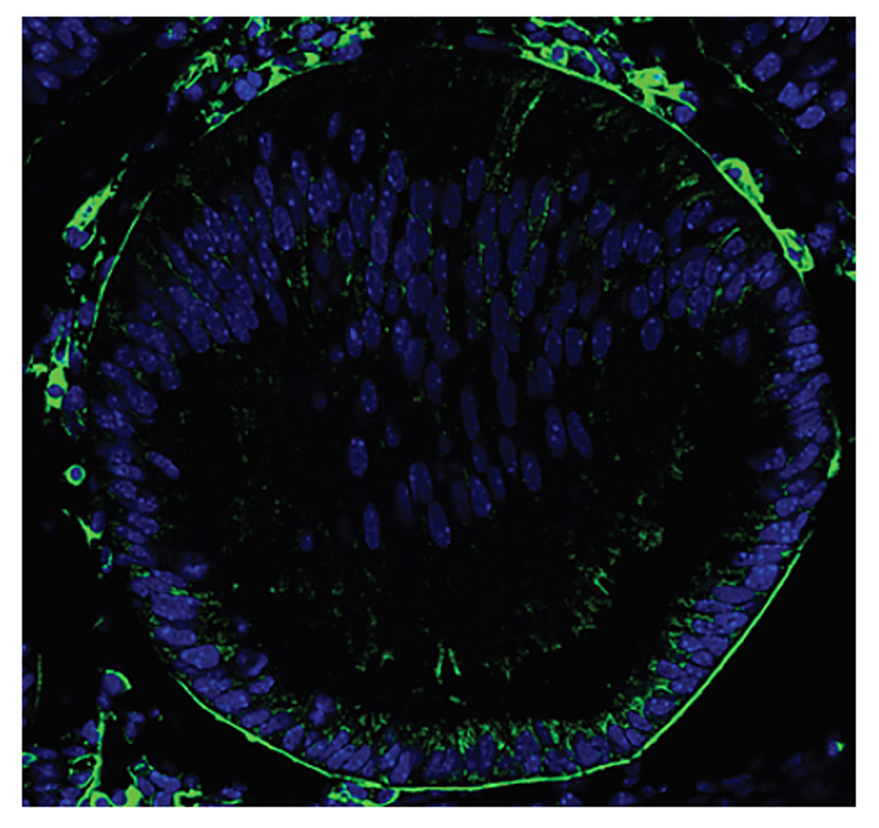 Frozen sections of E12.5 eyes from Col4a1+/+ mice were stained with Goat Anti-Type IV Collagen-UNLB (Cat. No. 98-507) followed by a secondary antibody and DAPI.

Image from Mao M, Kiss M, Ou Y, Gould DB. Genetic dissection of anterior segment dysgenesis caused by a Col4a1 mutation. Dis Model Mech. 2017 Feb 24. doi: 10.1242/dmm.027888. [Epub ahead of print]. Figure S6 (a)