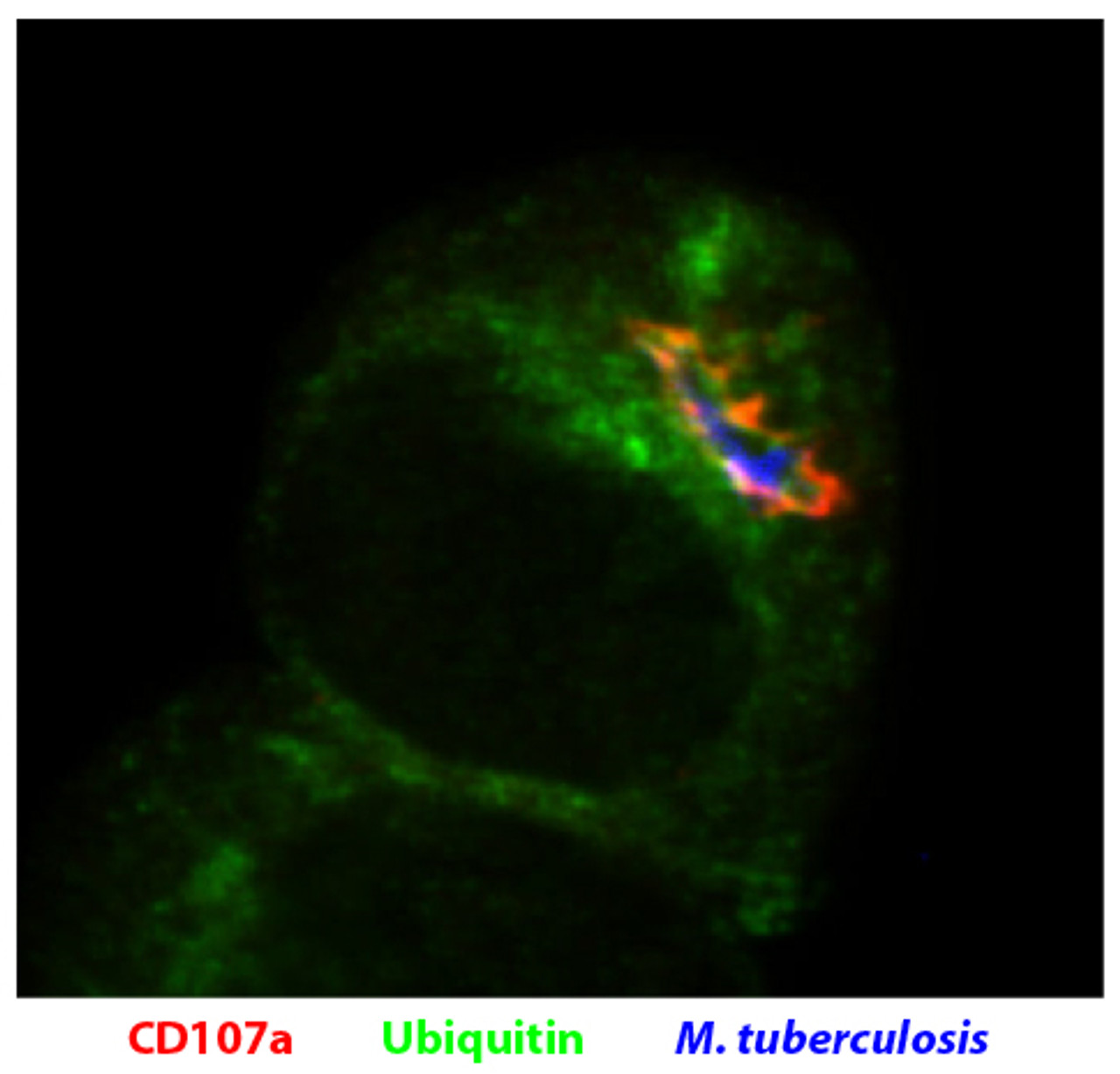 DC2.4 cells were infected with AF405 labeled M. tuberculosis and stained with Rat Anti-Mouse CD107a-UNLB (Cat. No. 99-109) and anti-ubiquitin followed by secondary antibodies.

Image from Seto S, Tsujimura K, Horii T, Koide Y. Autophagy adaptor protein p62-SQSTM1 and autophagy-related gene Atg5 mediate autophagosome formation in response to Mycobacterium tuberculosis infection in dendritic cells. PLoS One. 2013;8 (12) :e86017. Figure 4 (c)