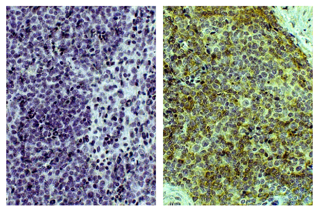 Paraffin embedded chicken spleen tissue was stained with Mouse Anti-Chicken Bu-1-UNLB (Cat. No. 99-310; right) followed by Anti-Mouse IgG-HRP and DAB.