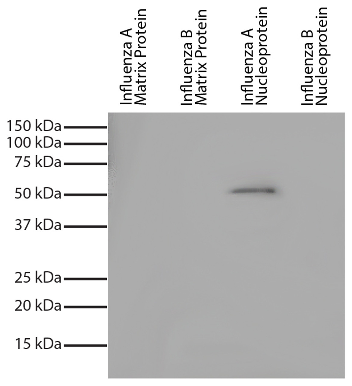 Recombinant influenza proteins were resolved by electrophoresis, transferred to PVDF membrane, and probed with Mouse Anti-Influenza A, Nucleoprotein-UNLB (Cat. No. 99-733) . Proteins were visualized using Goat Anti-Mouse IgG, Human ads-HRP and with chemiluminescent detection.