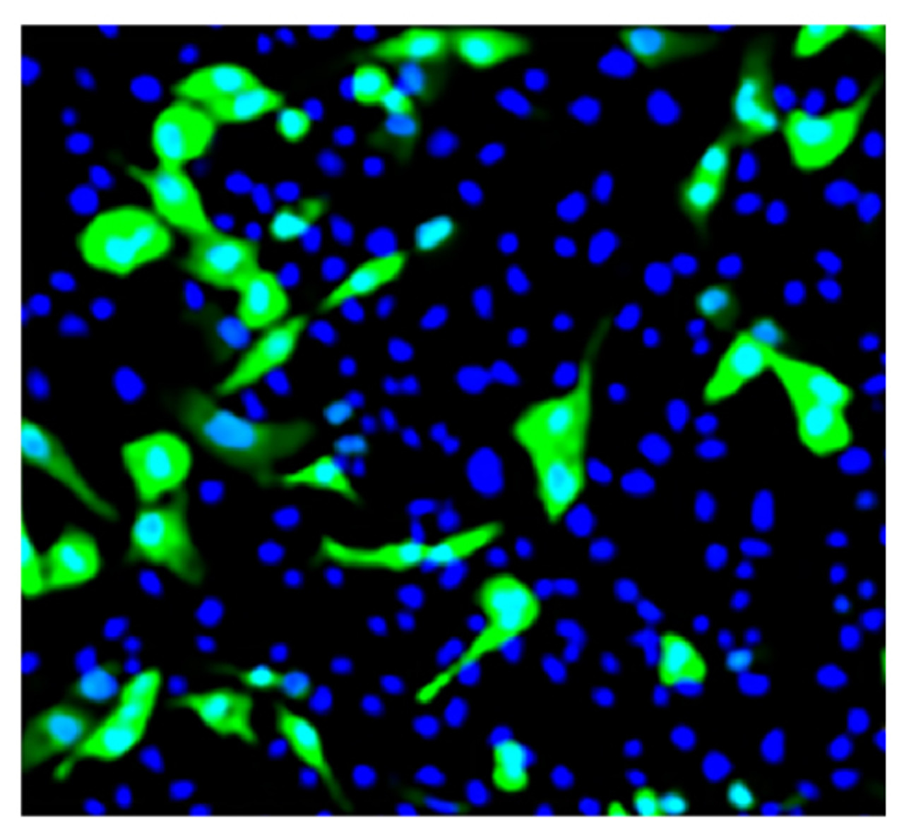 MDCK cells infected with the influenza A (H1N1) virus were stained with Mouse Anti-Influenza A, Nucleoprotein-UNLB (Cat. No. 99-734) followed by a secondary antibody and DAPI.

Image from Shoji M, Woo S, Masuda A, Win NN, Ngwe H, Takahashi E, et al. Anti-influenza virus activity of extracts from the stems of Jatropha multifida Linn. collected in Myanmar. BMC Complement Altern Med. 2017;17:96. Figure 3 (a)