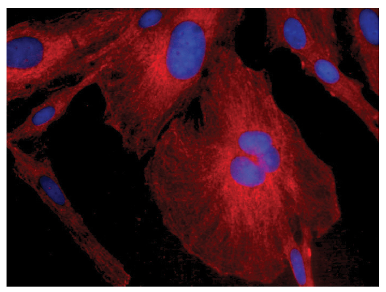 Human astrocytoma cell line CCF-STTG1 was stained with Mouse Anti-Human GFAP-CY3 (Cat. No. 99-782) .