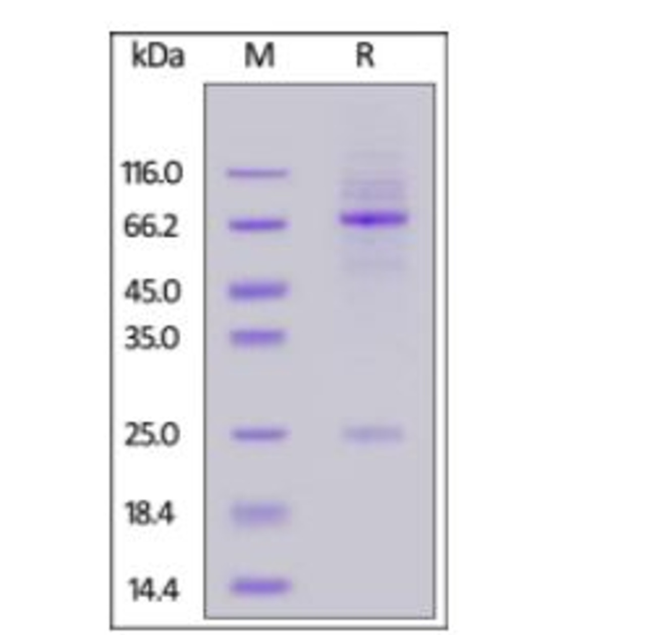 Anti-SARS-CoV-2 Spike RBD Antibody, Chimeric mAb, Human IgM on SDS-PAGE under reducing (R) condition. The gel was stained overnight with Coomassie Blue. The purity of the protein is greater than 85%.