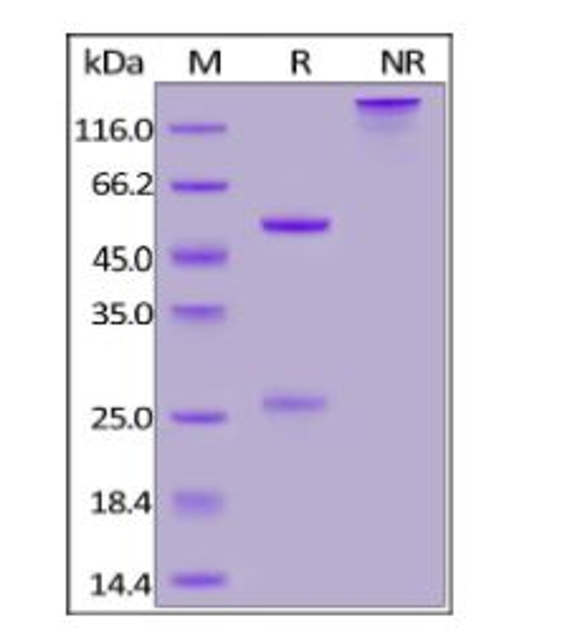 Anti-SARS-CoV-2 Nucleocapsid Antibody, Human IgG1 on SDS-PAGE under reducing (R) and non-reducing (NR) conditions. The gel was stained overnight with Coomassie Blue. The purity of the protein is greater than 95%.