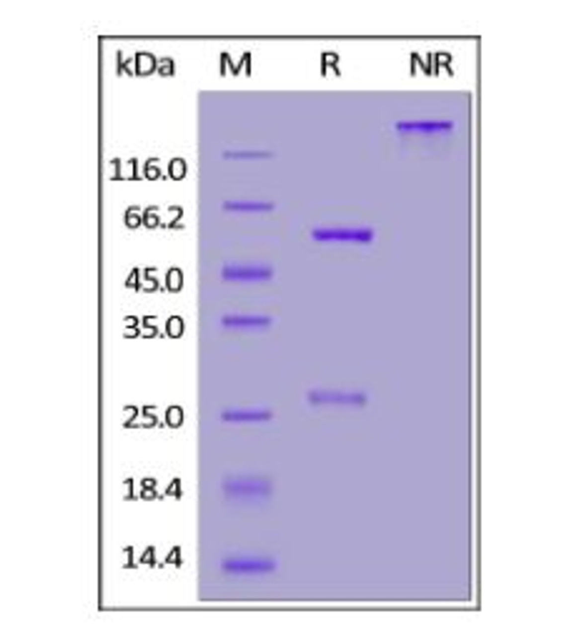 Anti-SARS-CoV-2 Nucleocapsid Antibody, Human IgG1 on SDS-PAGE under reducing (R) and non-reducing (NR) conditions. The gel was stained overnight with Coomassie Blue. The purity of the protein is greater than 95%.