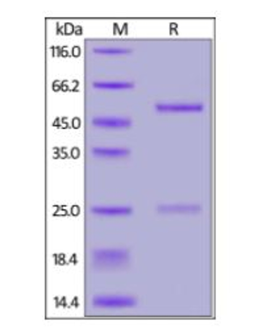 Anti-SARS-CoV-2 RBD Neutralizing Antibody, Human IgG1 on SDS-PAGE under reducing (R) condition. The gel was stained overnight with Coomassie Blue. The purity of the protein is greater than 95%.