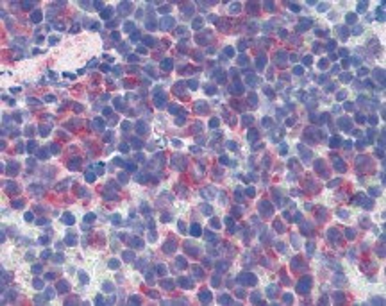 Immunohistochemistry of mouse spleen tissue stained using CD69 Monoclonal Antibody.