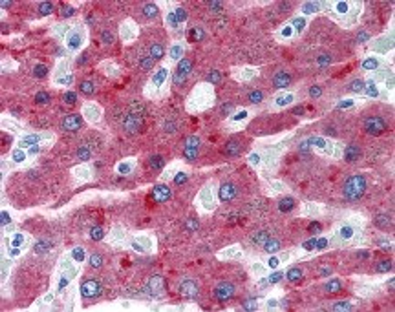 Human liver tissue stained with Factor H Antibody at 20 &#956;g/mL followed by biotinylated anti-mouse IgG secondary antibody, alkaline phosphatase-streptavidin and chromogen.