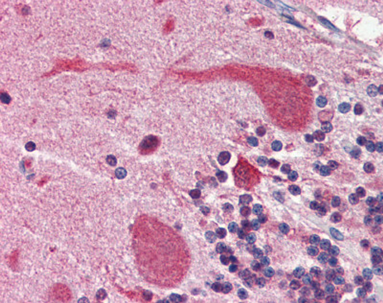 Human cerebellum tissue stained with Heat Shock Protein 90 (HSP90) Antibody at 5 &#956;g/mL followed by biotinylated anti-mouse IgG secondary antibody, alkaline phosphatase-streptavidin and chromogen.