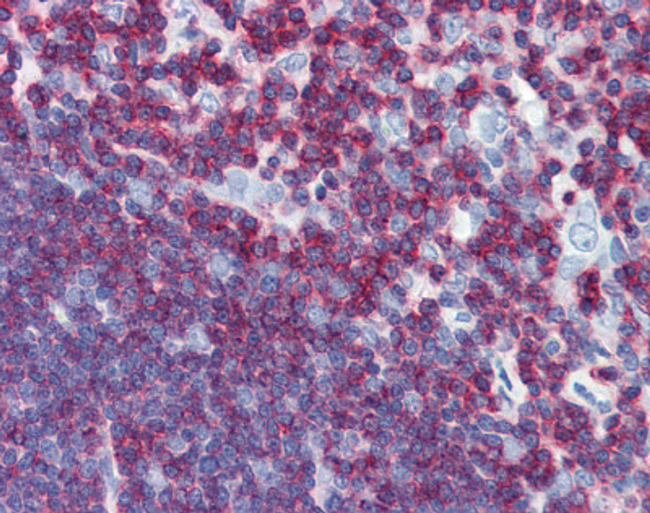 Human thymus tissue stained with CD45 Antibody at 10 &#956;g/mL followed by biotinylated anti-mouse IgG secondary antibody, alkaline phosphatase-streptavidin and chromogen.