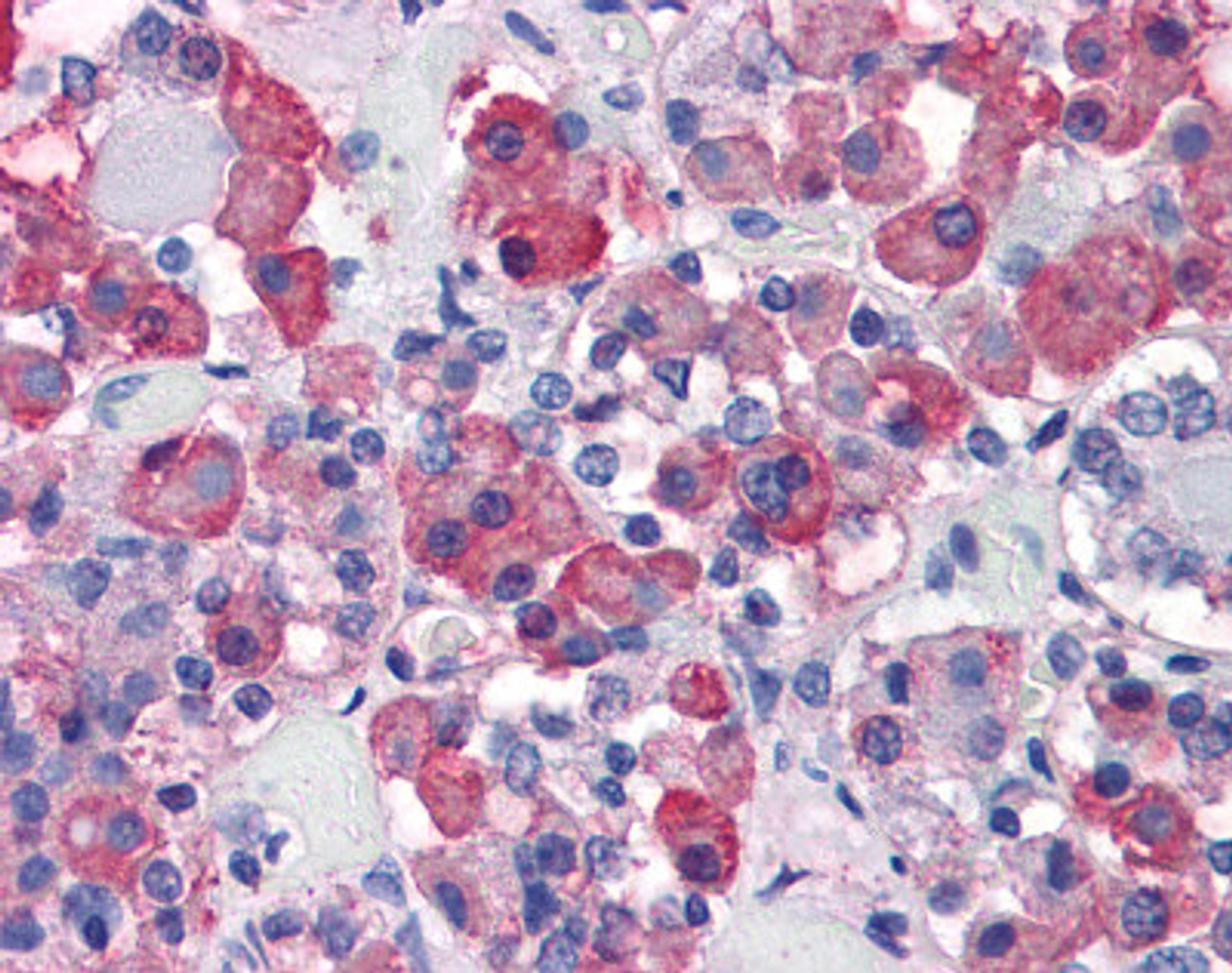 Immunohistochemistry of human anterior pituitary tissue stained using Growth Hormone Monoclonal Antibody.