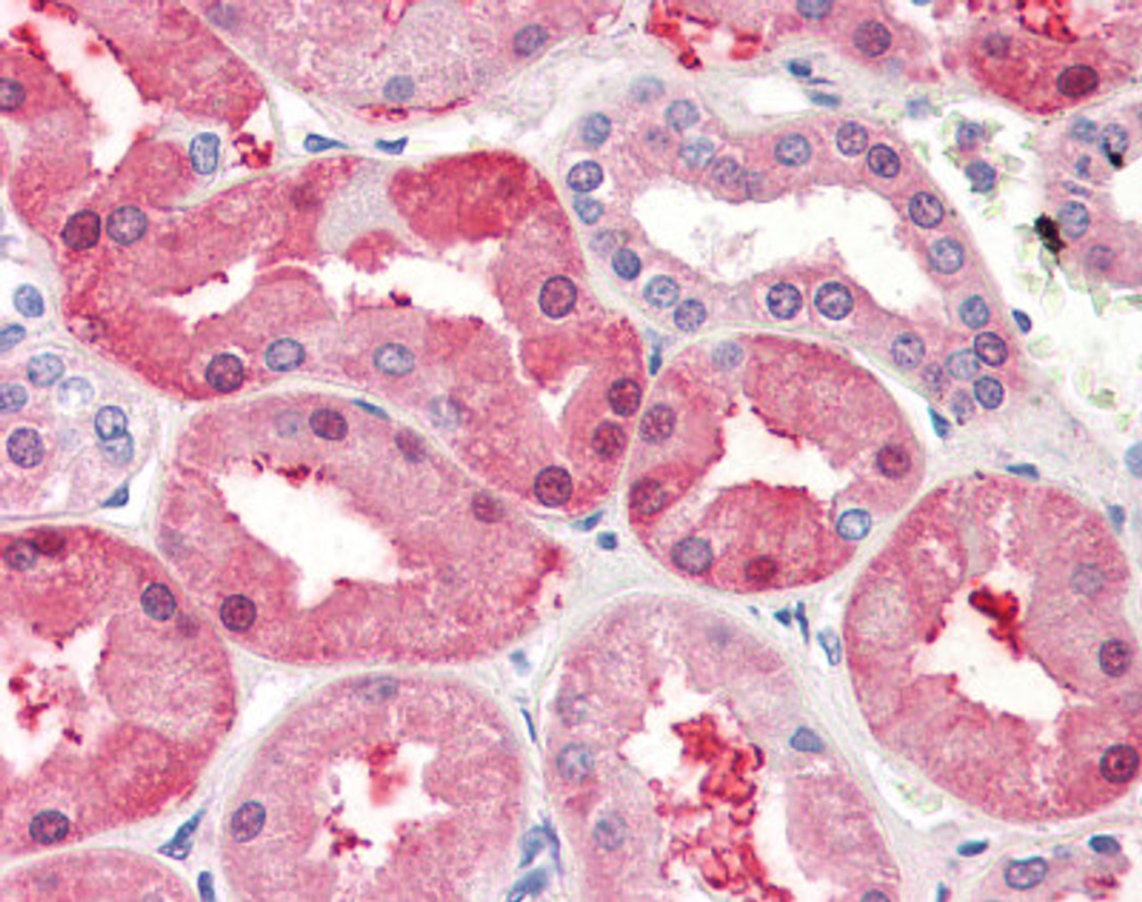 Human kidney tissue stained with FABP1 Antibody at 5 &#956;g/mL followed by biotinylated anti-mouse IgG secondary antibody, alkaline phosphatase-streptavidin and chromogen.