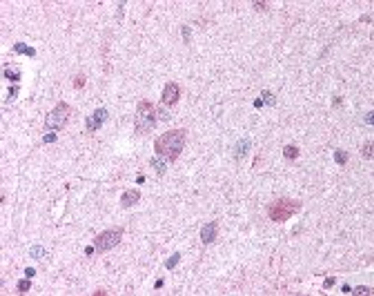 Immunohistochemistry staining of PAEL receptor in brain cortex tissue using PAEL receptor Antibody.