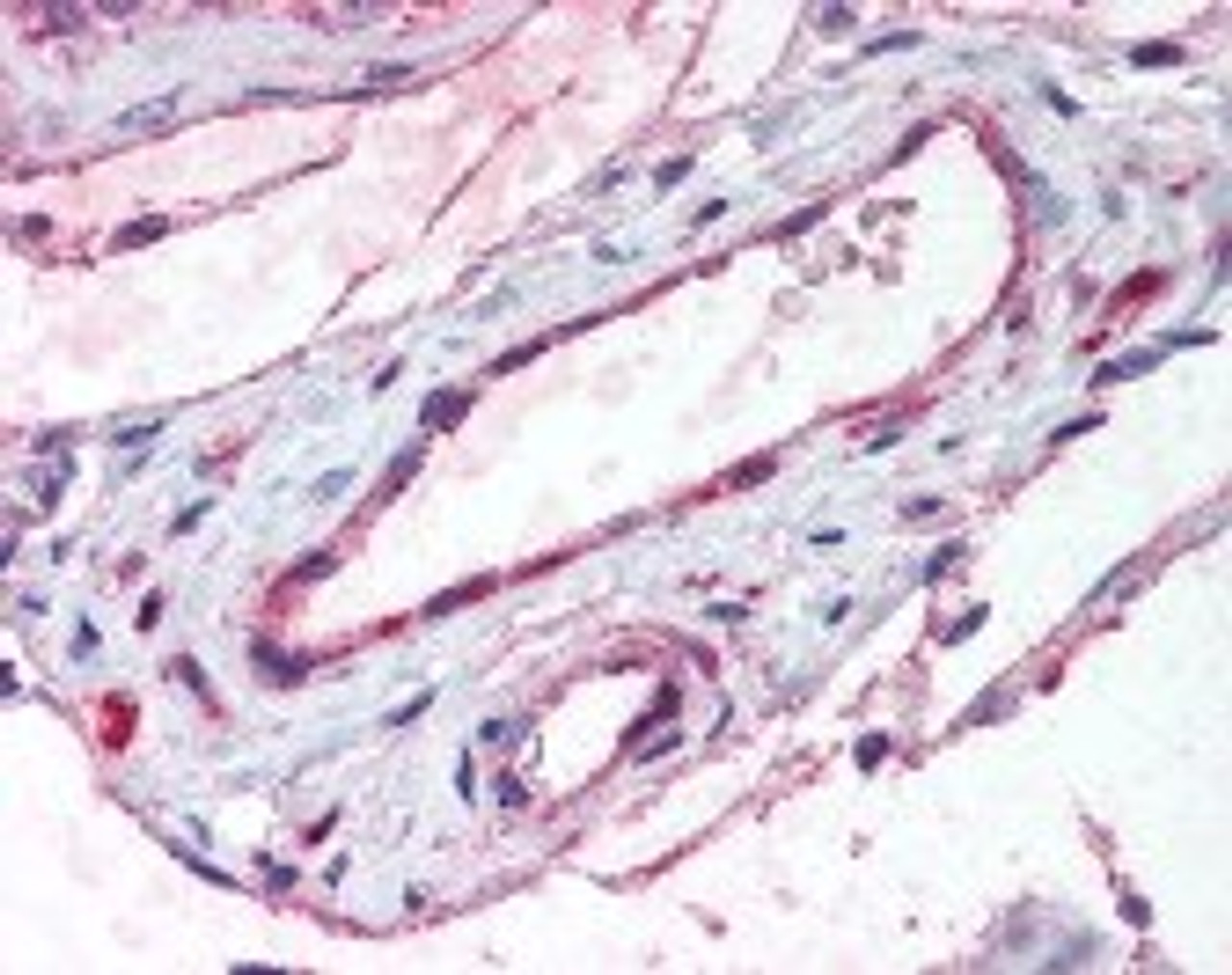 Immunohistochemistry staining of ADAMTS1 in testis, vessels tissue using ADAMTS1 Antibody.