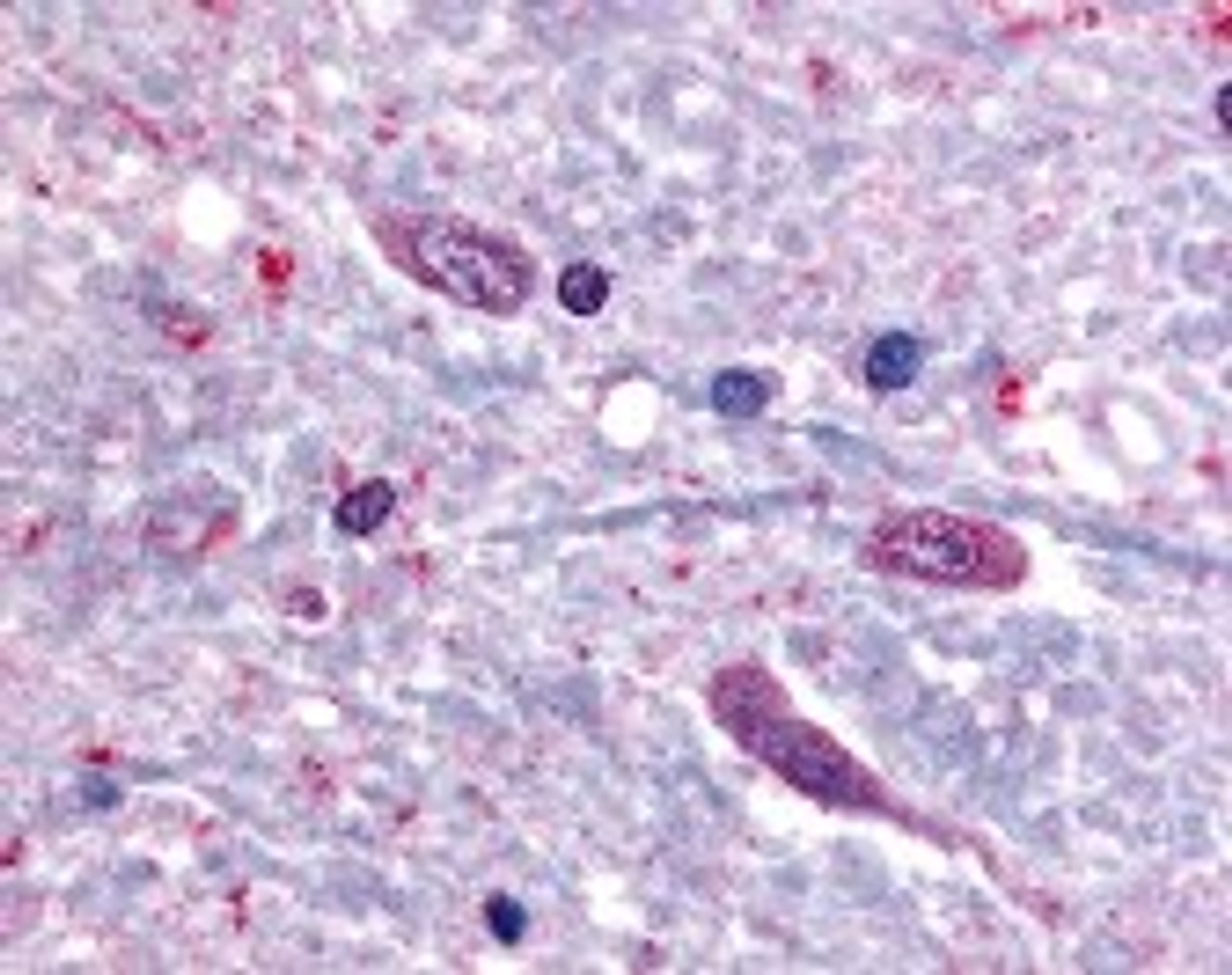 Immunohistochemistry staining of SLC5A3 in spinal cord tissue using SLC5A3 Antibody.