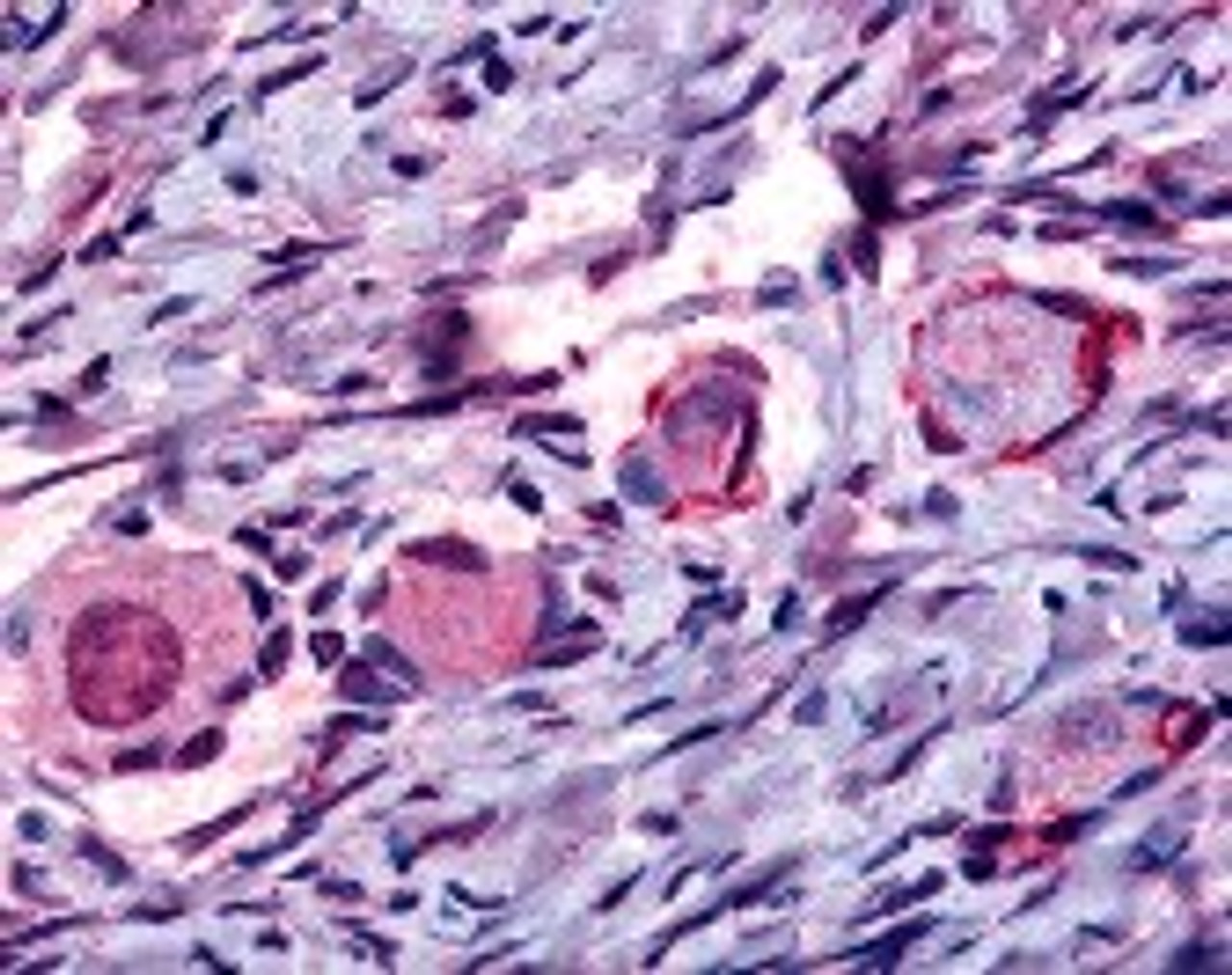 Immunohistochemistry staining of NR4A1 in primary follicles tissue using NR4A1 Antibody.