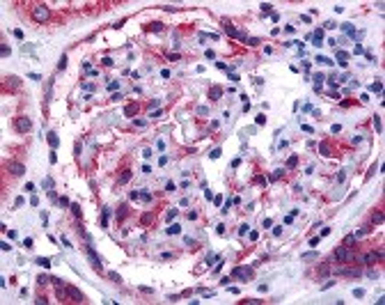 Immunohistochemistry staining of EPHA4 in glomerulus tissue using EPHA4 Antibody.