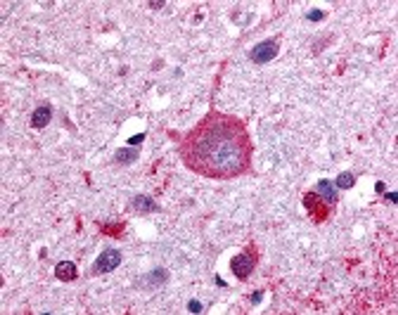 Immunohistochemistry staining of GPRC5B in brain cortex tissue using GPRC5B Antibody.
