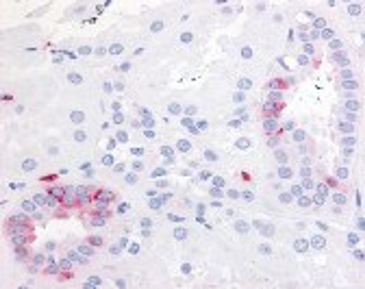 Immunohistochemistry staining of PTGER2 in kidney tissue using PTGER2 Antibody.