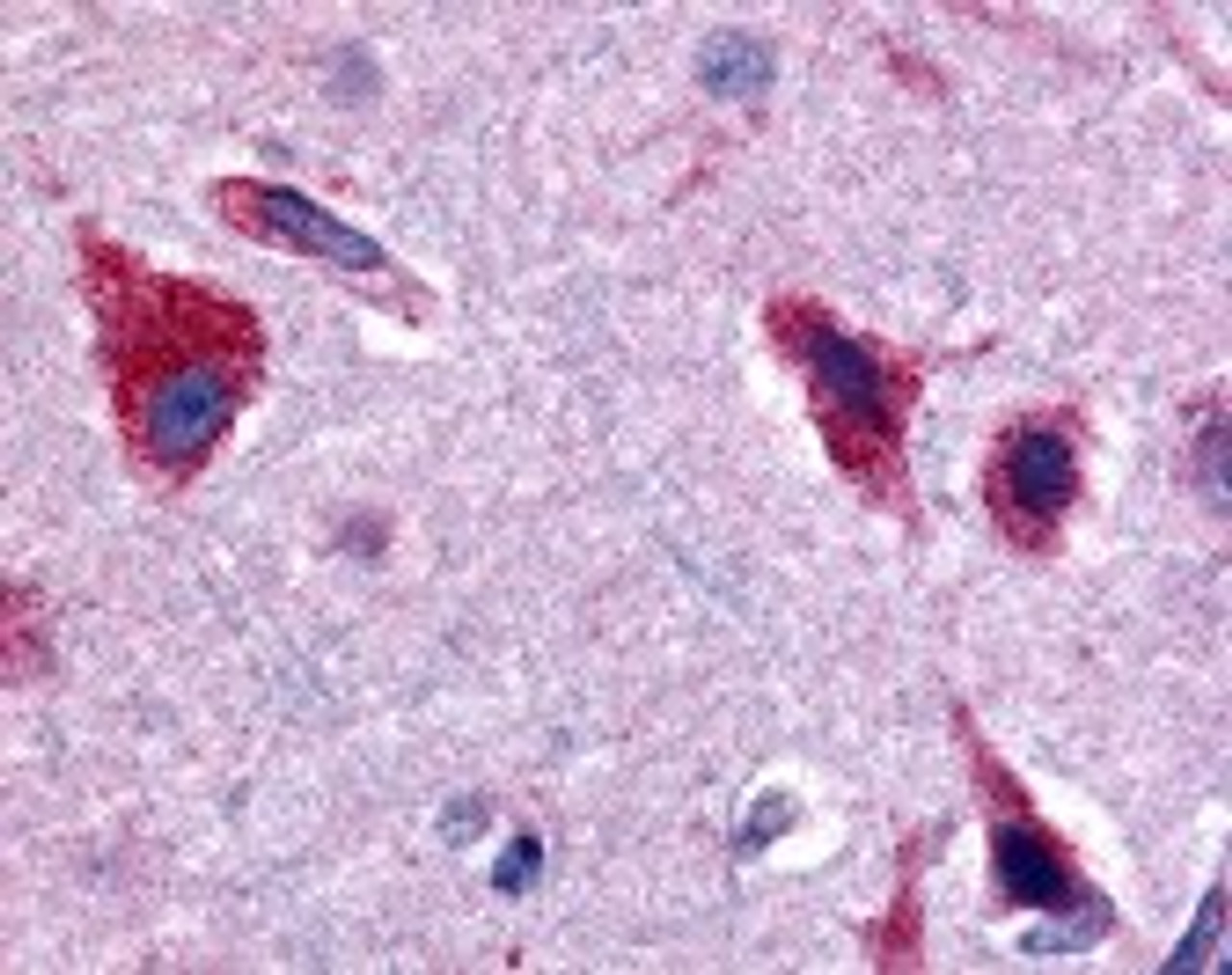 Immunohistochemistry staining of Ceramide Kinase in brain cortex tissue using Ceramide Kinase Antibody.