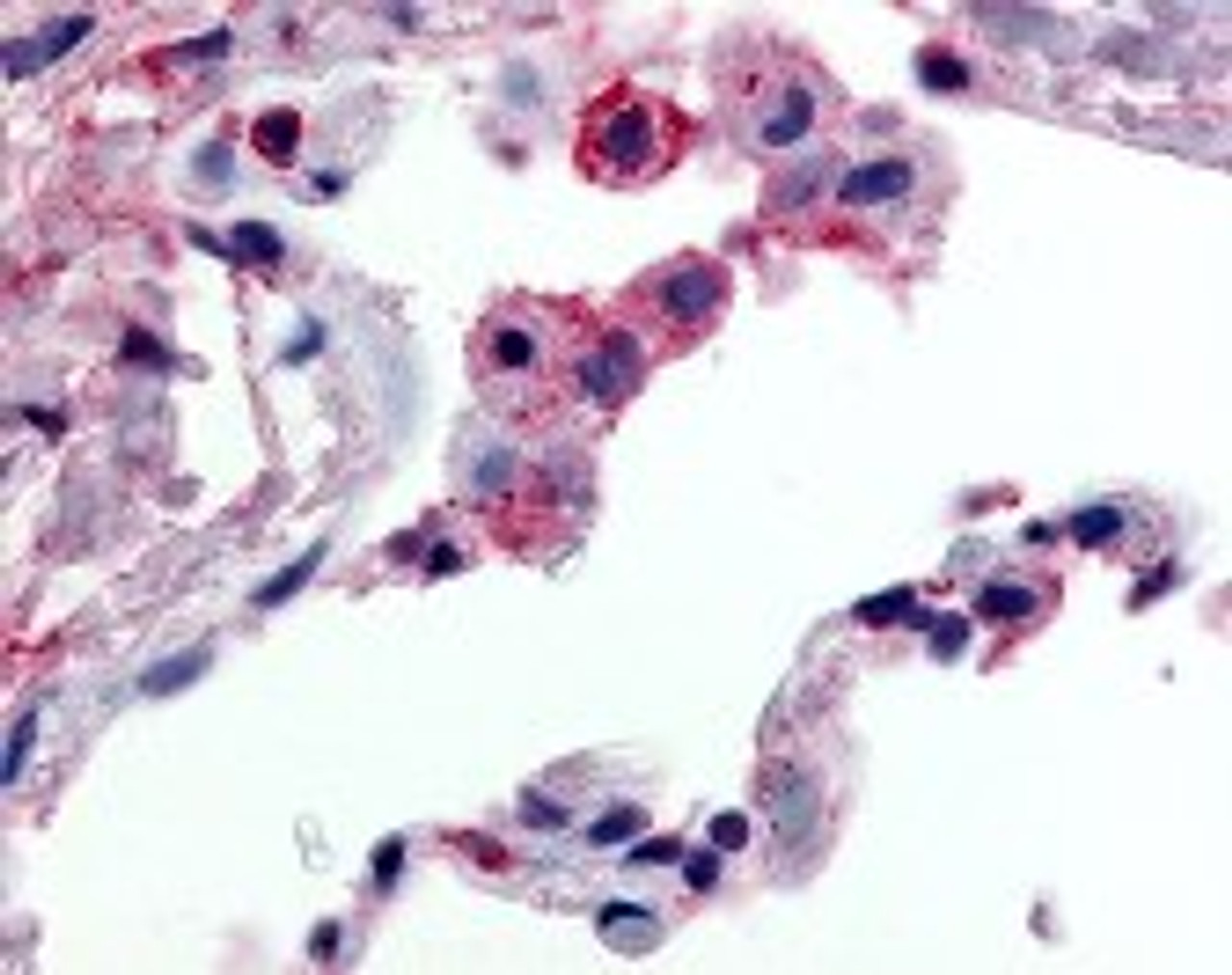 Immunohistochemistry staining of FFAR2 in lung, alveolar macrophages tissue using FFAR2 Antibody.