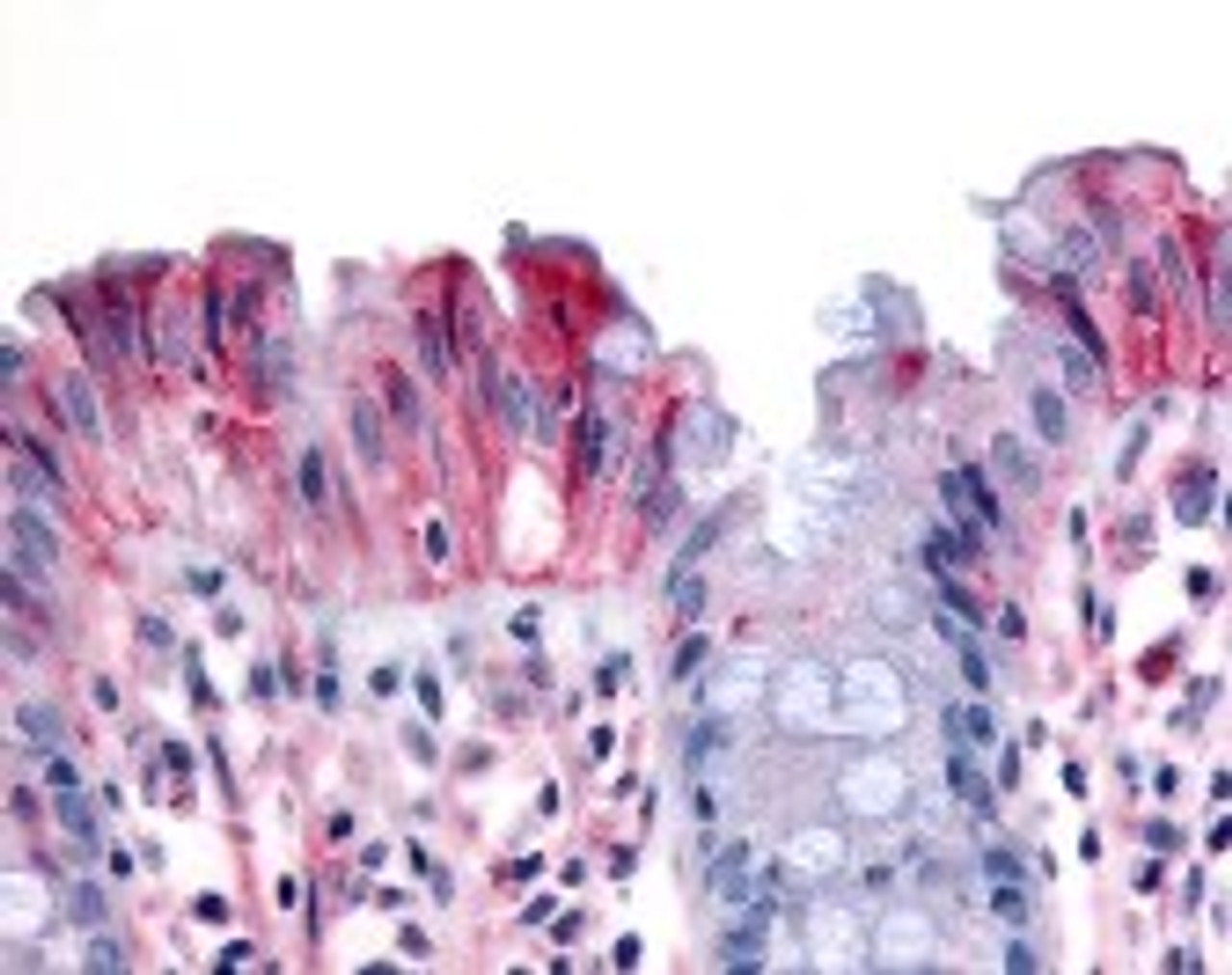 Immunohistochemistry staining of MST1R in colon, surface epithelium tissue using MST1R Antibody.