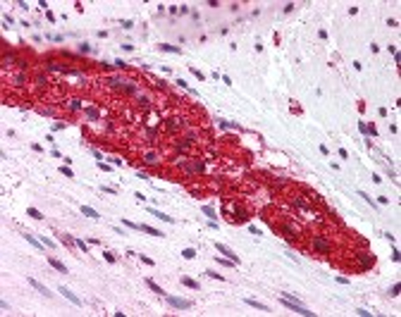 Immunohistochemistry staining of GRM5 in colon, myenteric plexus tissue using GRM5 Antibody.