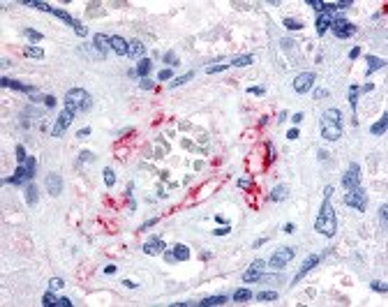 Immunohistochemistry staining of FLT1 in placenta, fetal capillary endothelial cells using FLT1 Antibody.