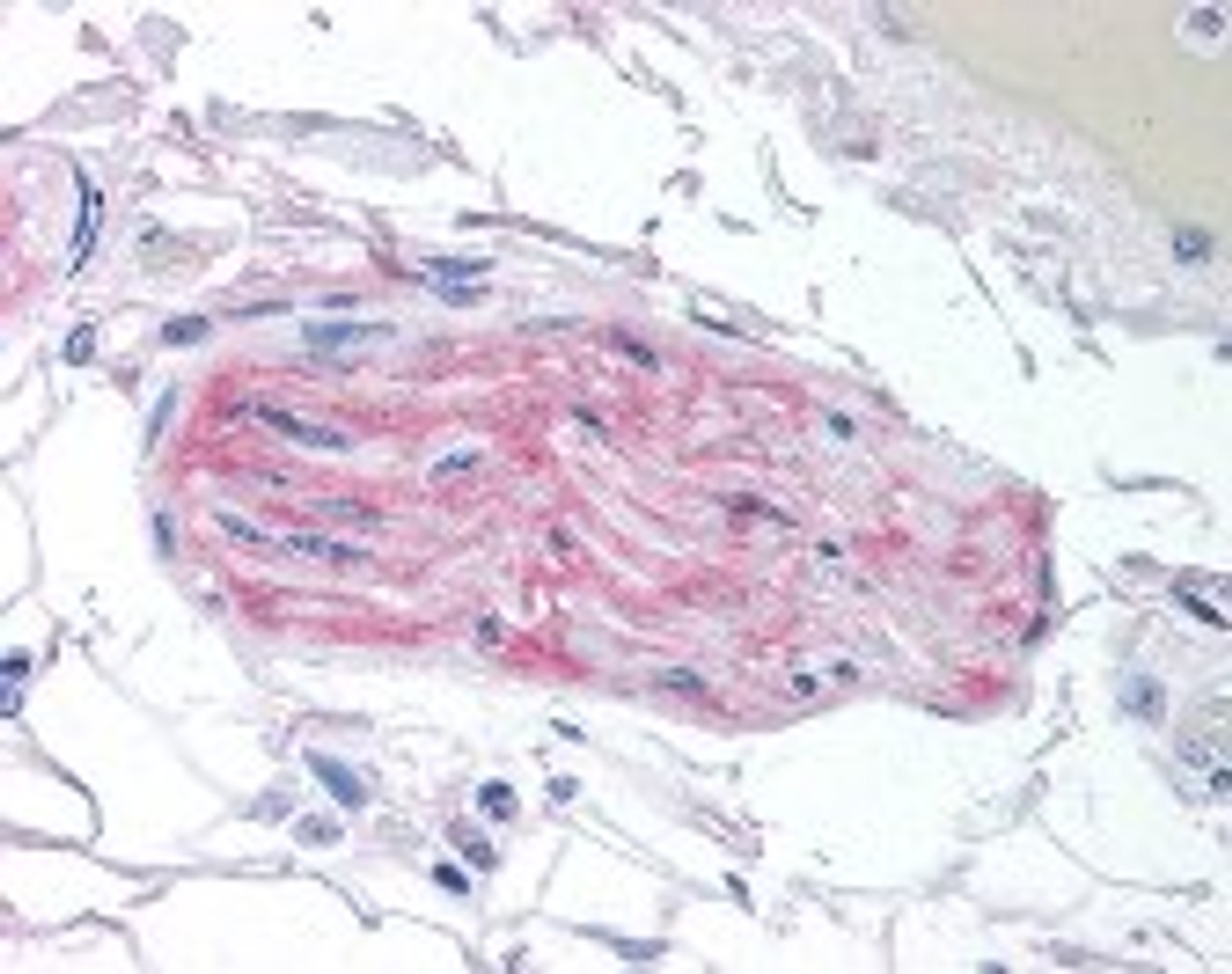 Immunohistochemistry staining of IKBKAP in lung, nerve tissue using IKBKAP Antibody.