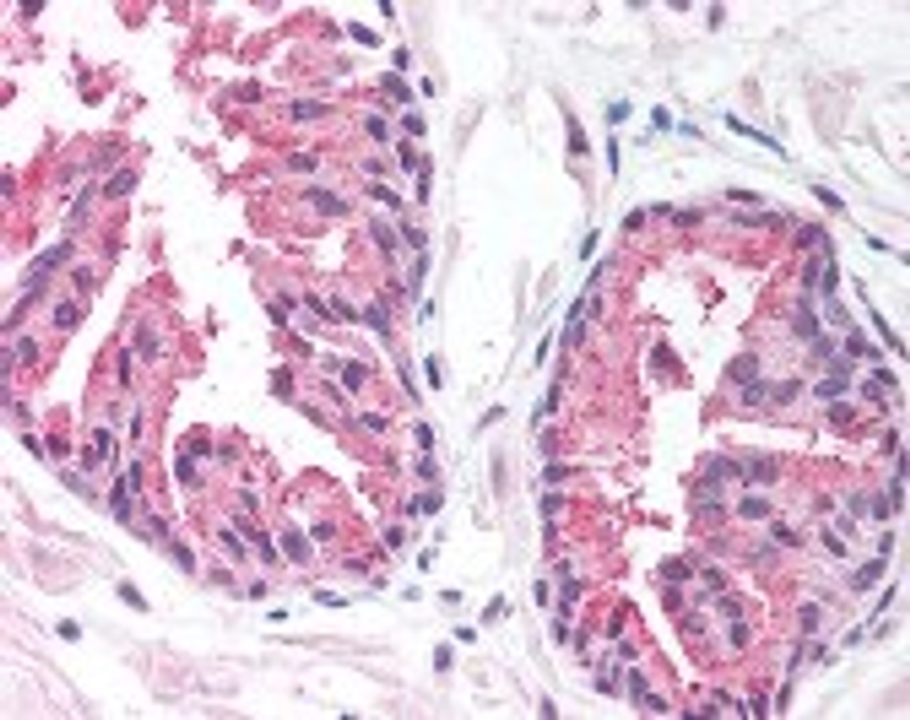 Immunohistochemistry staining of MCTS1 in prostate tissue using MCTS1 Antibody.