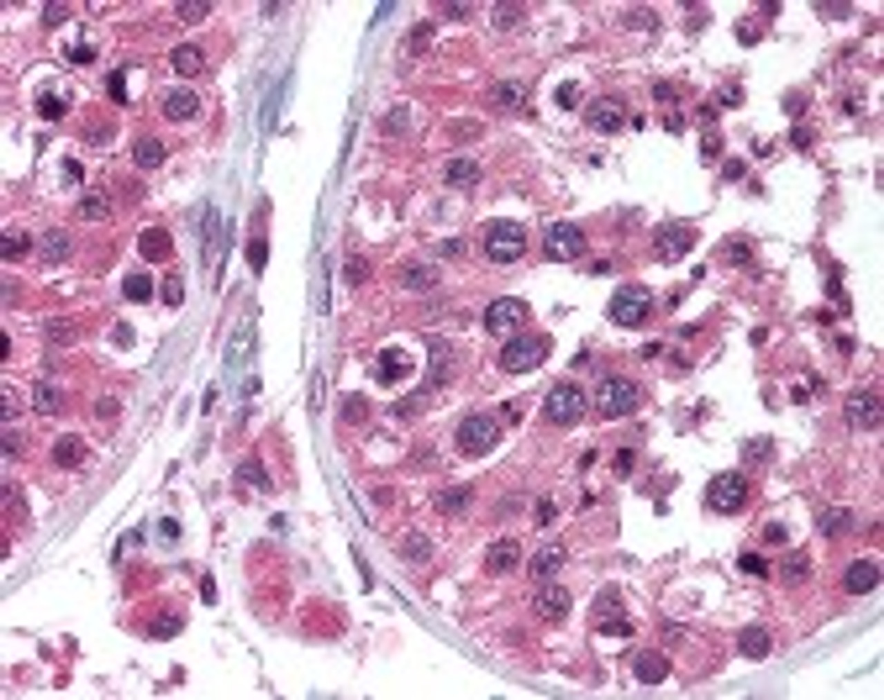 Immunohistochemistry staining of TEGT in testis tissue using TEGT monoclonal Antibody.