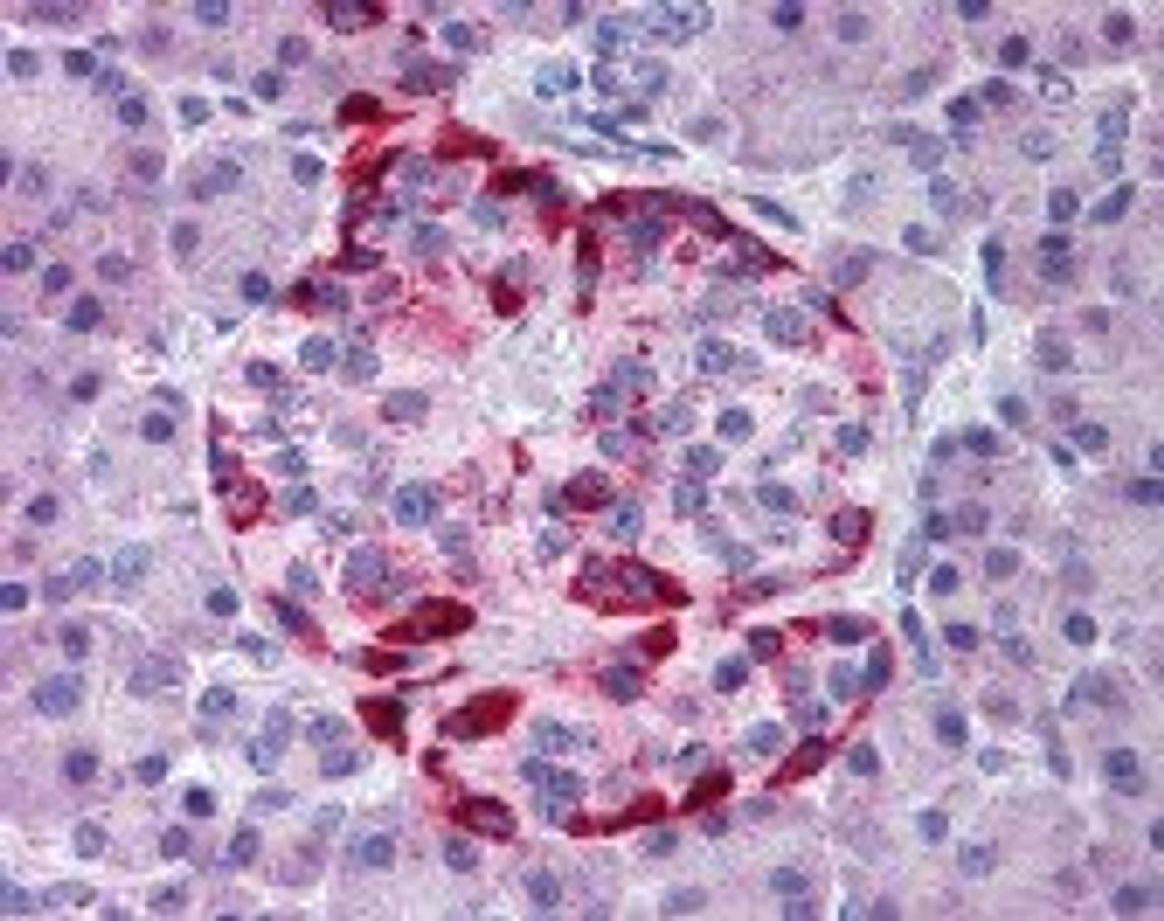 Immunohistochemistry staining of EPHA2 in pancreas tissue using EPHA2 Antibody.