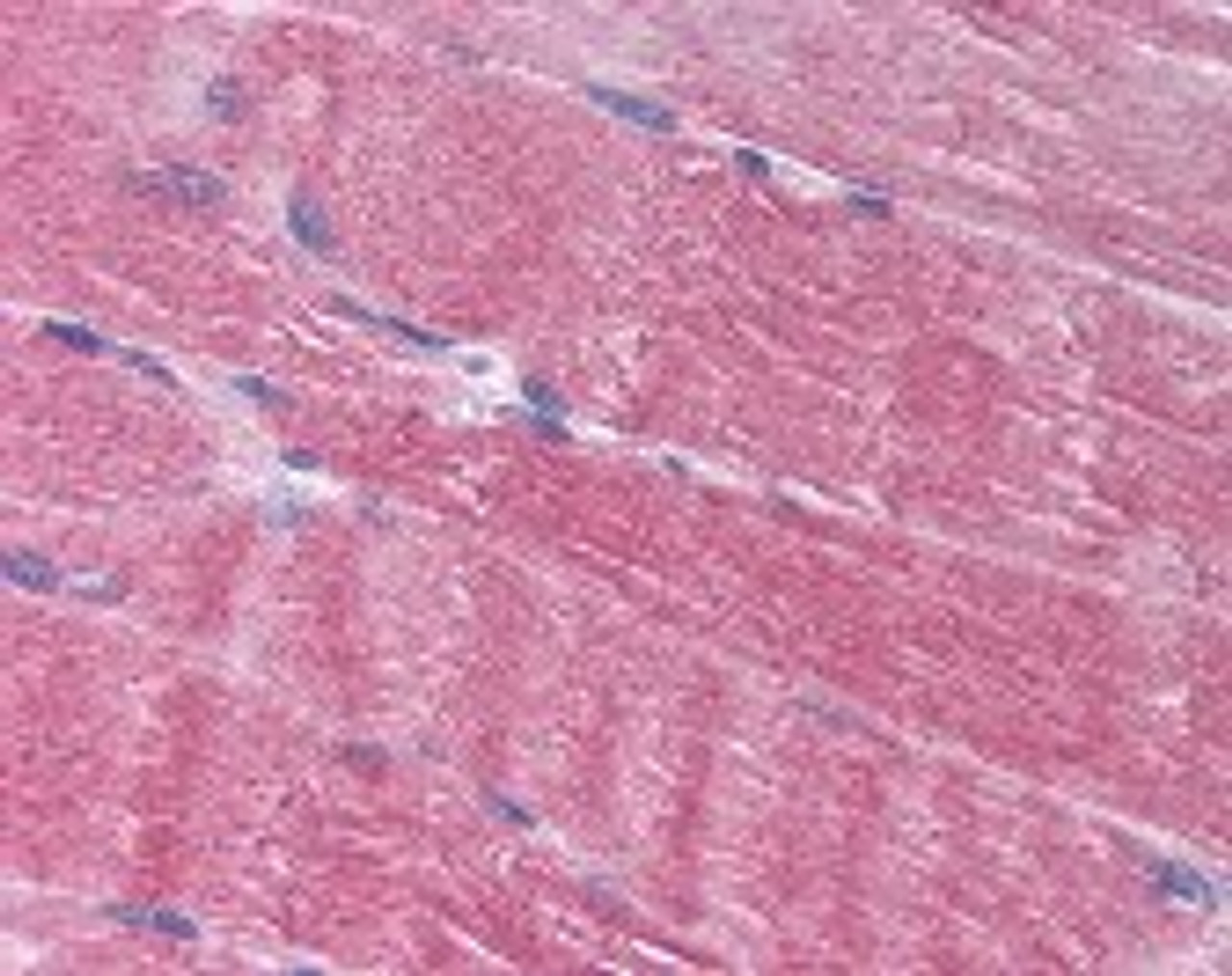Immunohistochemistry staining of AMPD1 in skeletal muscle tissue using AMPD1 Antibody.