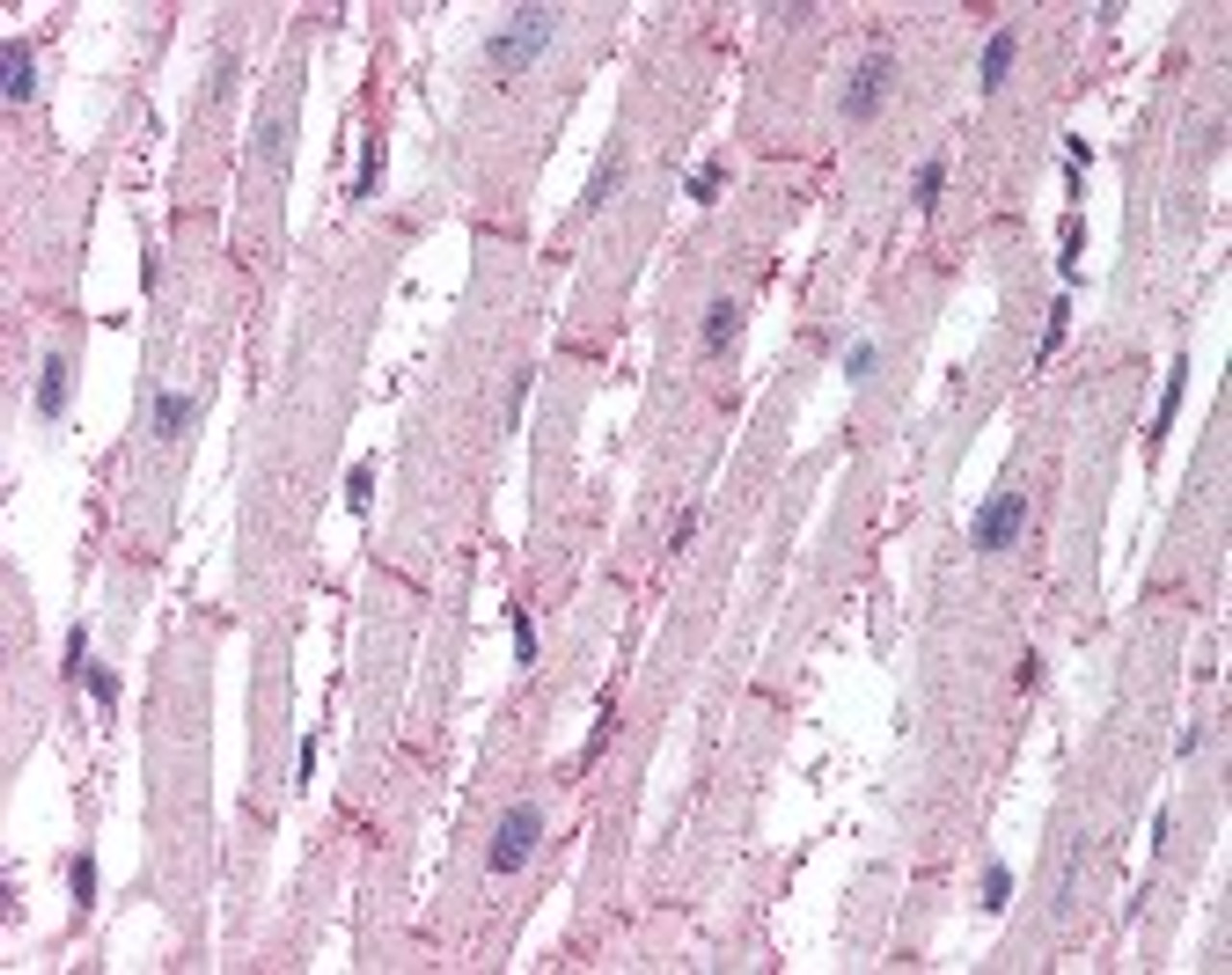 Immunohistochemistry staining of ATG4B in heart (formalin-fixed paraffin embedded) tissue using ATG4B Antibody.