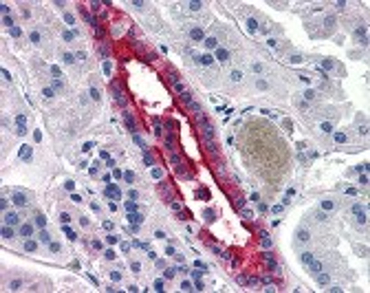 Immunohistochemistry staining of Aquaporin 2 in kidney (formalin-fixed paraffin embedded) tissue using Aquaporin 2 Antibody.