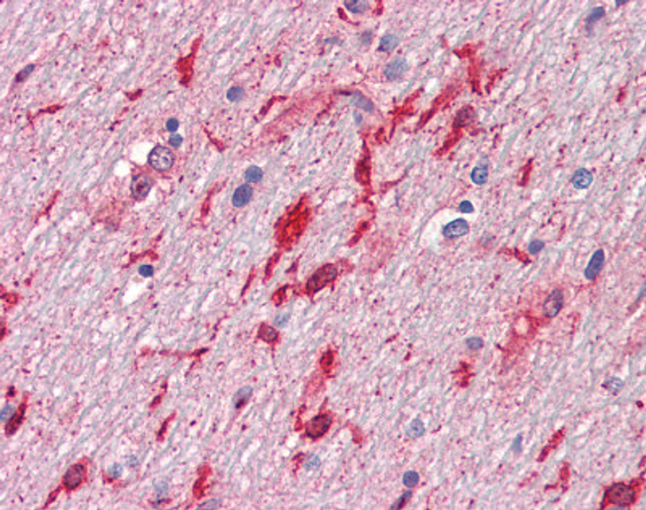 Human cerebellum, white matter tissue stained with HGF Antibody at 10 &#956;g/mL followed by biotinylated anti-mouse IgG secondary antibody, alkaline phosphatase-streptavidin and chromogen.