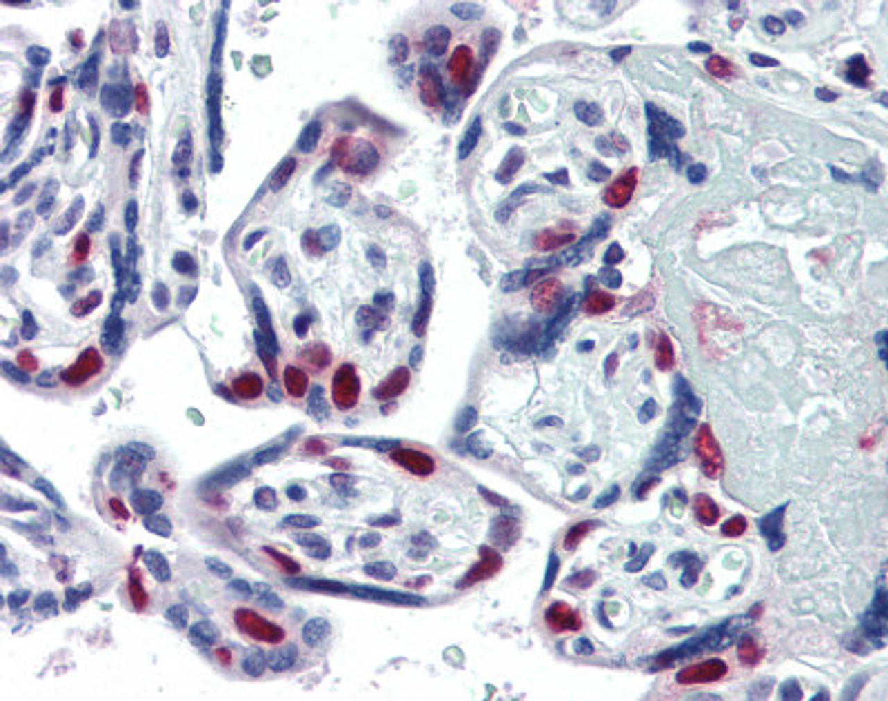 Human placenta tissue stained with PARP1 Antibody, alkaline phosphatase-streptavidin and chromogen.