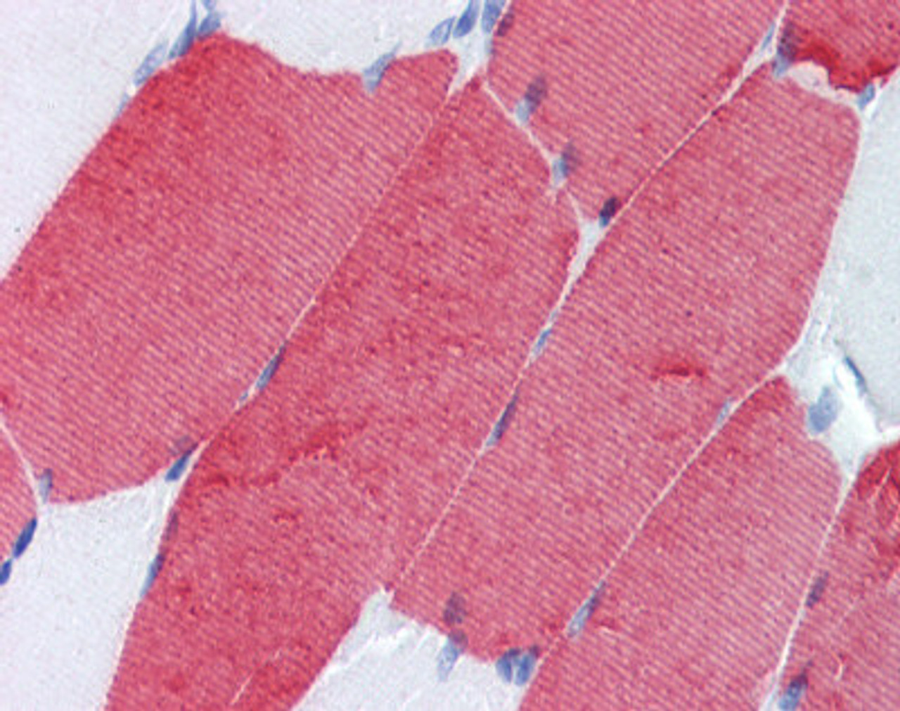 Human skeletal muscle tissue stained with TNNT3 Antibody, alkaline phosphatase-streptavidin and chromogen.