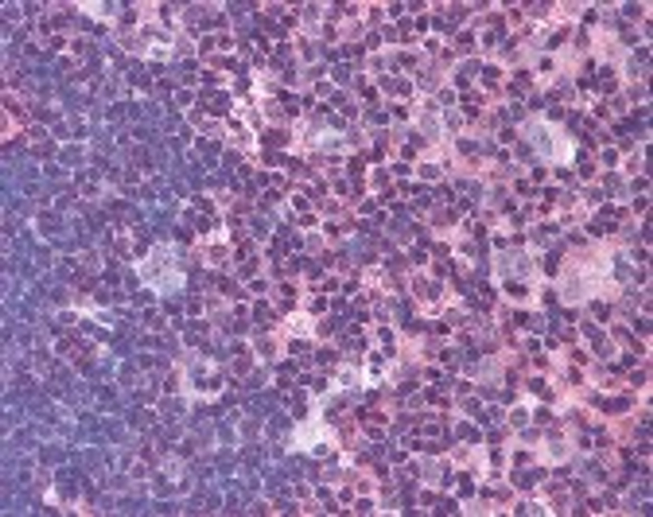 Immunohistochemistry staining of BLM in thymus tissue using BLM Antibody.