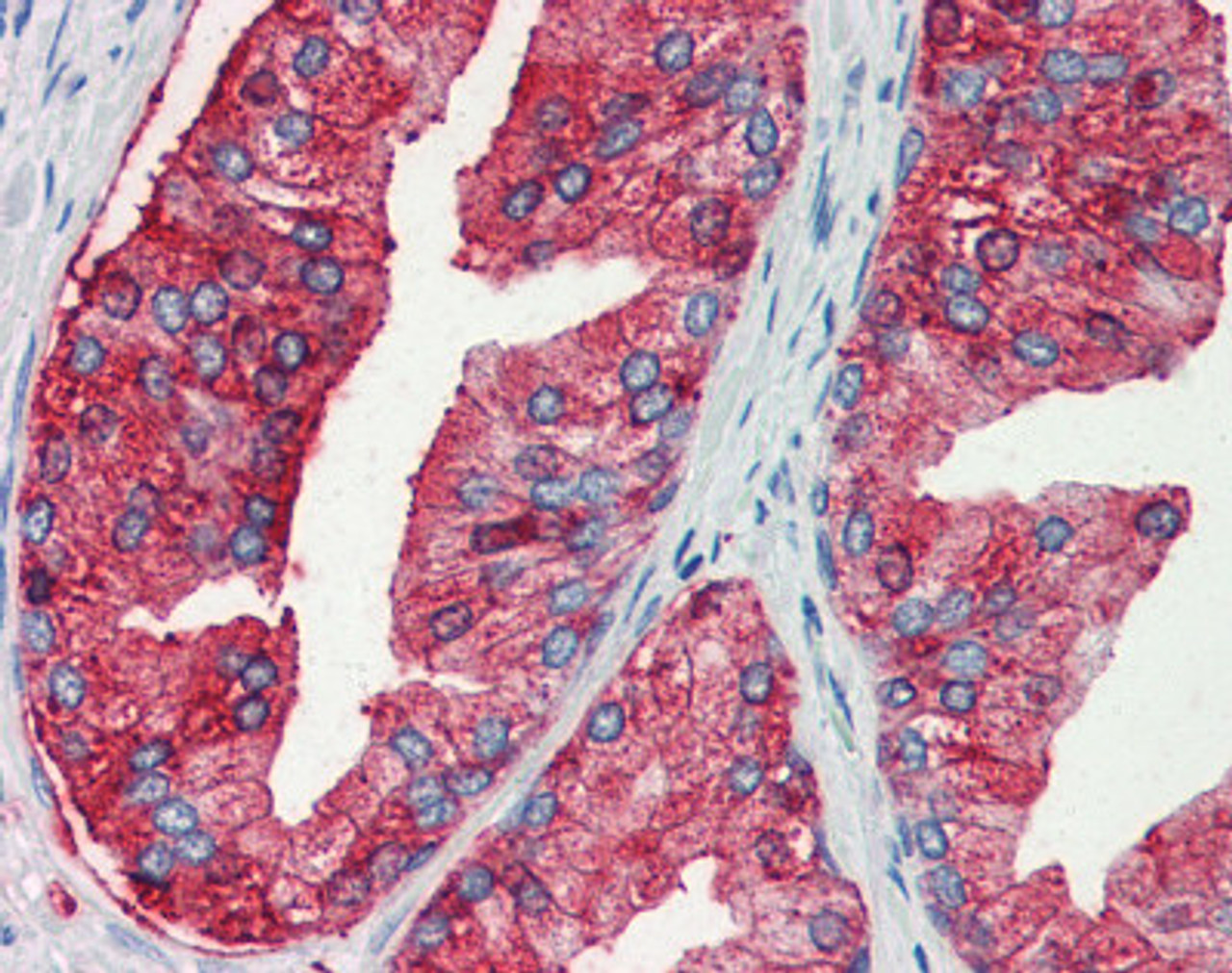 Immunohistochemistry staining of Mucin 13 in prostate tissue using Mucin 13 Antibody.